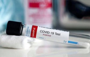 Ενημέρωση από τον Δήμο Ναυπλιέων για ενέργειες μετά τον εντοπισμό κρούσματος Κορωνοιού σε μέλος της ομάδας του Πανναυπλιακού