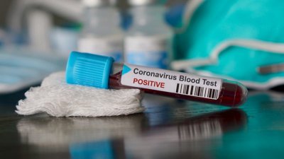 ΔΗΜΟΣ ΝΑΥΠΛΙΕΩΝ – Δ.Ο.ΚΟΙ.Π.Α.Ν. : Αρνητικά όλα τα τεστ Covid – 19 στους υπαλλήλους Βρεφικών  και  Νηπιακών  Σταθμών